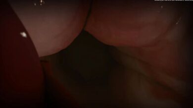 The Breast Reckoning: Eskos Booby Adventure, Chapter II Part 1