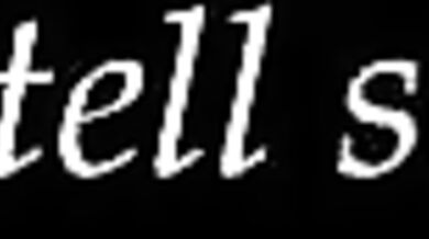 An Innocent Surgery - Patient 04