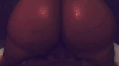 Private Eye Exam: Patient #1 with Adani Devi