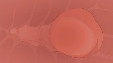 "Mastering The Eeveelution - A Stripper's Story"