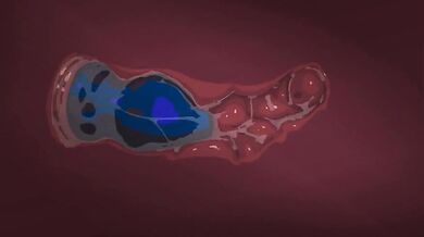 Breaking the Princess - Sleeping Beauty