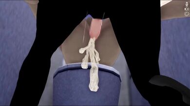 You cant watch this video because it is too explicit or has been removed